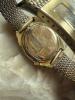 BACK OF WATCH